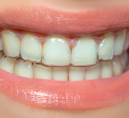 Traitements cabinet d'orthodontie Migault